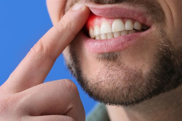 Egy férfi az ínyét mutatja, amely vérzik, jelezve a szájüregi problémákat.